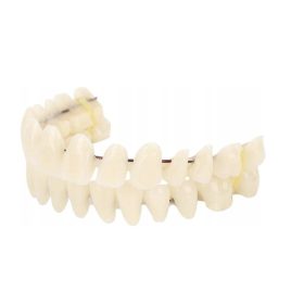  Gyanta protézis A2-es fogakhoz