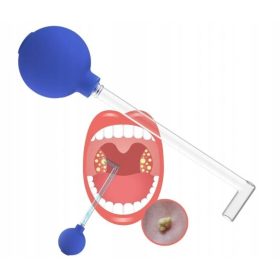  Kézi mandulatisztító eszköz kőeltávolító körte